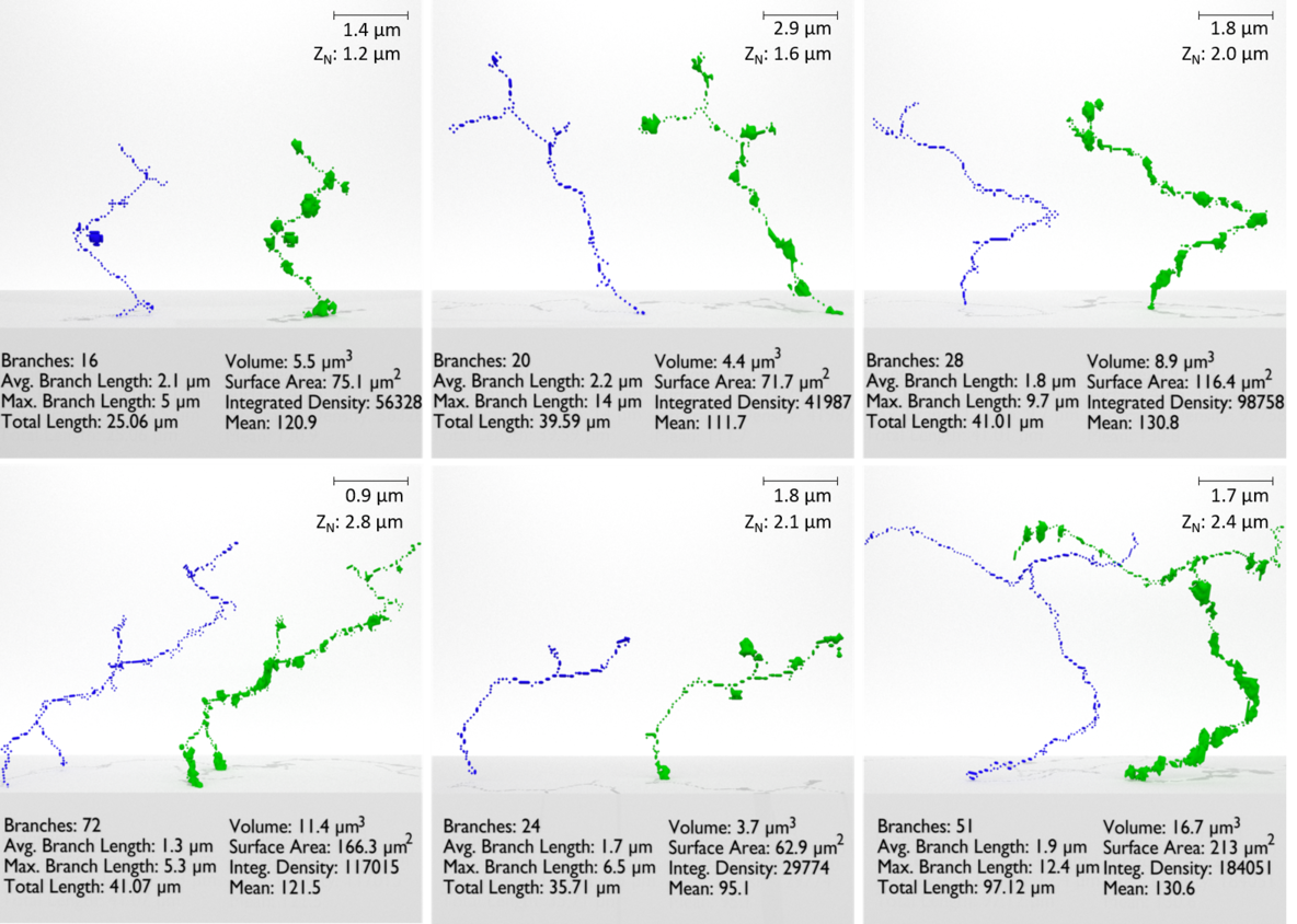 mbaresearchdaybioartrz.png michael anderson