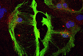 Microscopic photograph of nervous system cells. Microscopic photograph of nervous system cells.